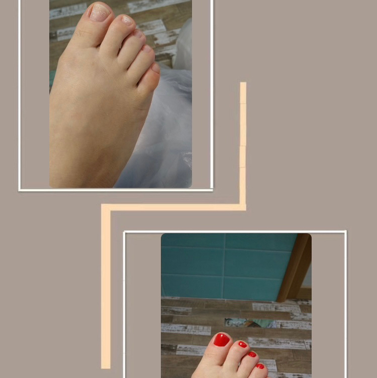 Обработка пальчиков без обработки стопы с покрытием однотон(без проблем и изменений ногтей)