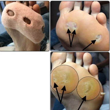 Работа с омозолелостями