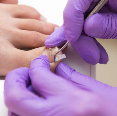 Установка тампонады