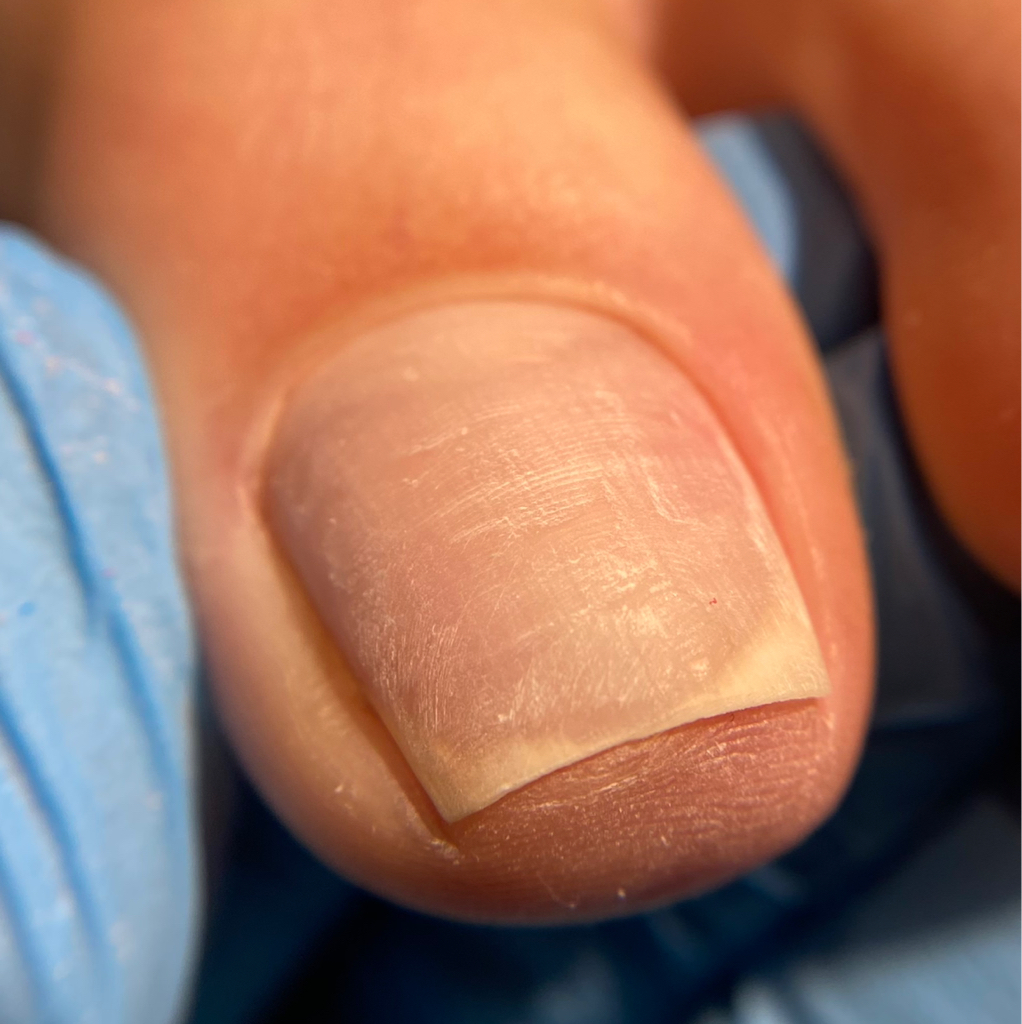 Педикюр женский