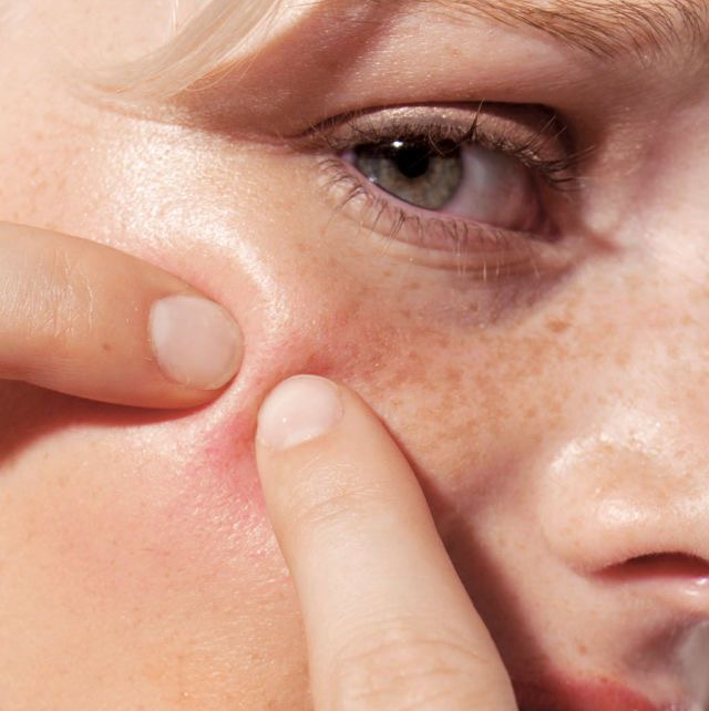 Атравматичная чистка