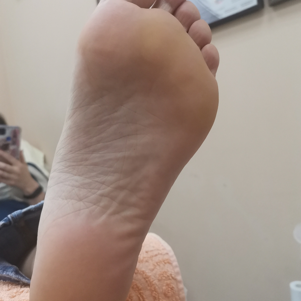 Аппаратный педикюр