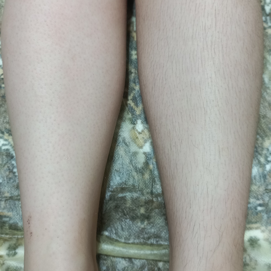 Ноги до колена