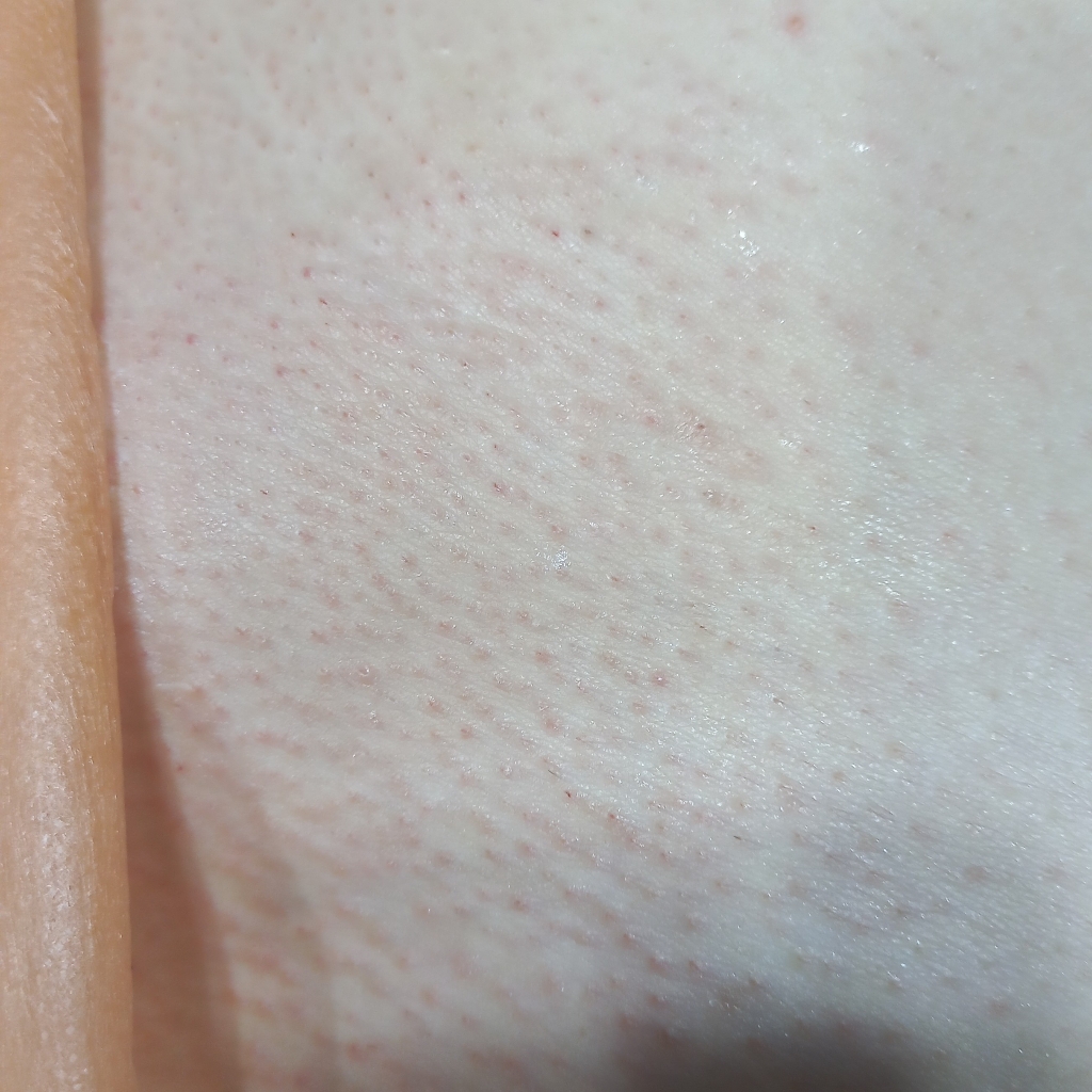 Бикини глубокое