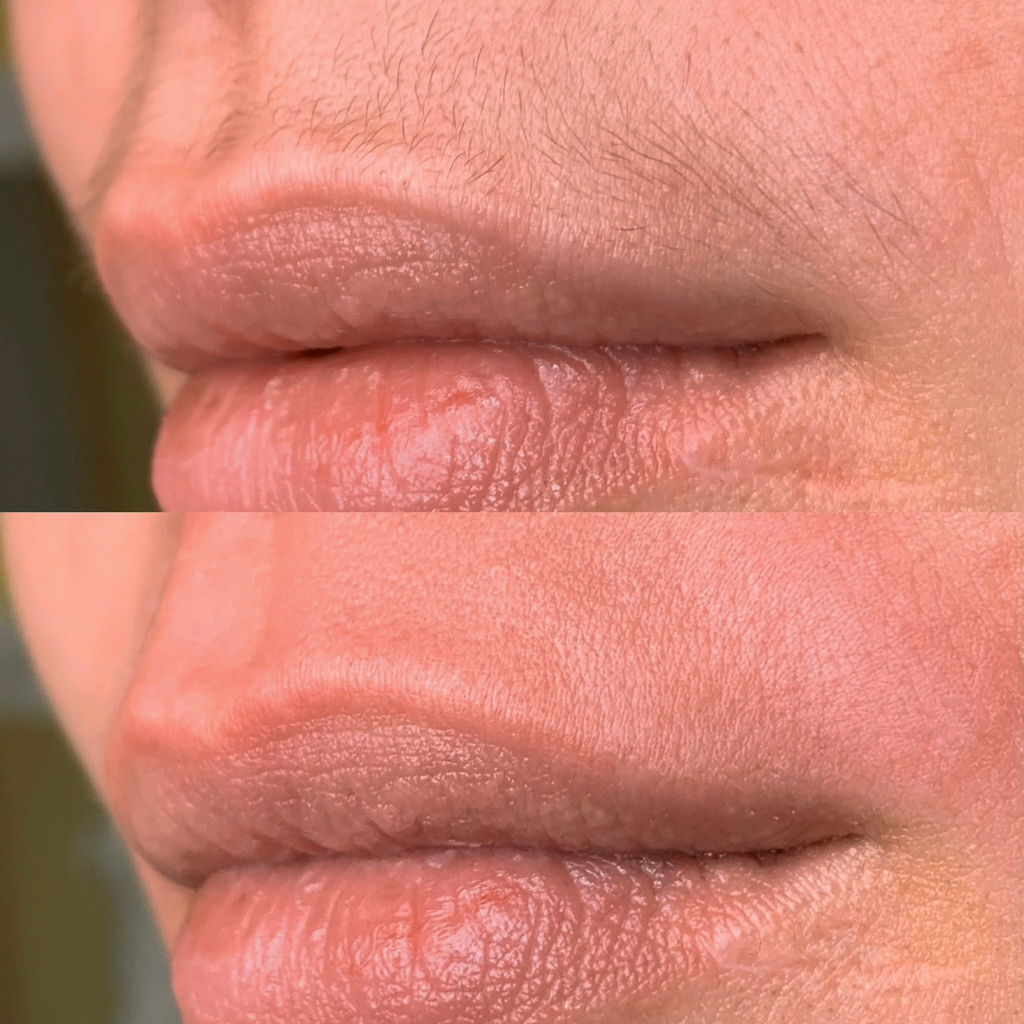 Ваксинг лица ( 1 зона )