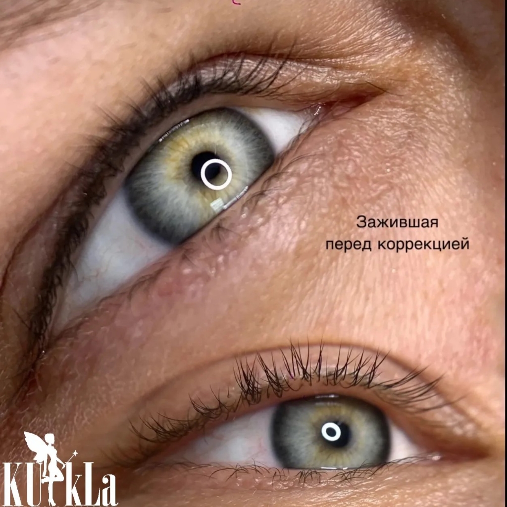 ПМ межресничка