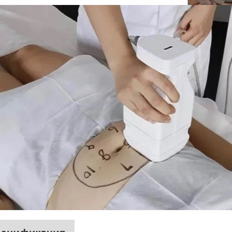 SMAS лифтинг - тело (Liposonic)