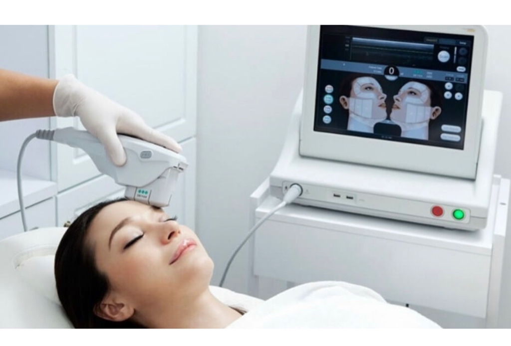 Ultraformer SMAS лифтинг - периорбитальная зона (вокруг глаз)