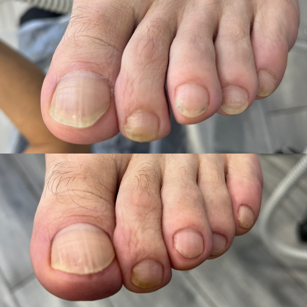PEDICURE SMART MAN педикюр мужской