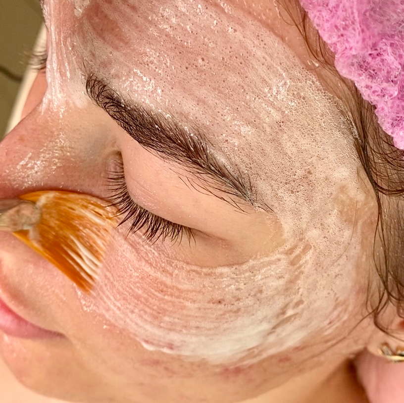 Карбокситерапия