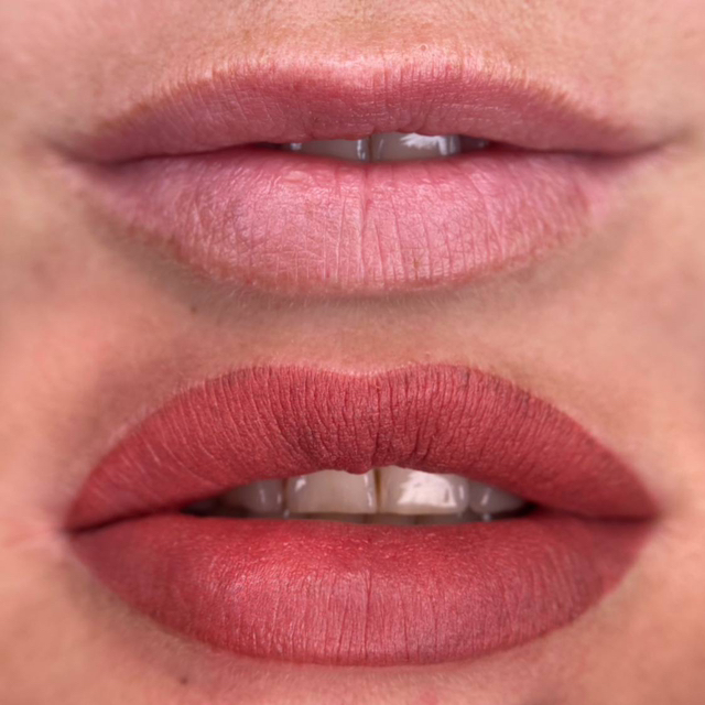 Губы коррекция