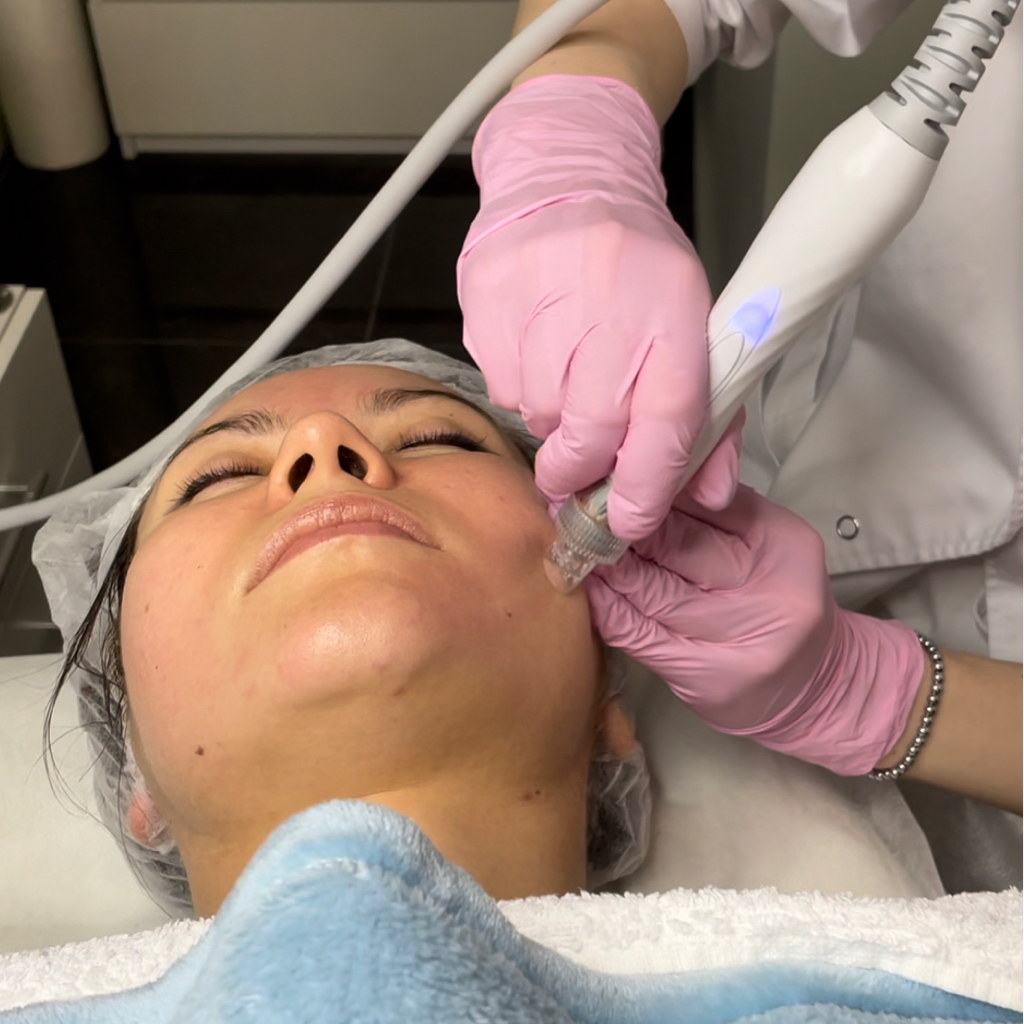Hydra Facial лицо: полное очищение