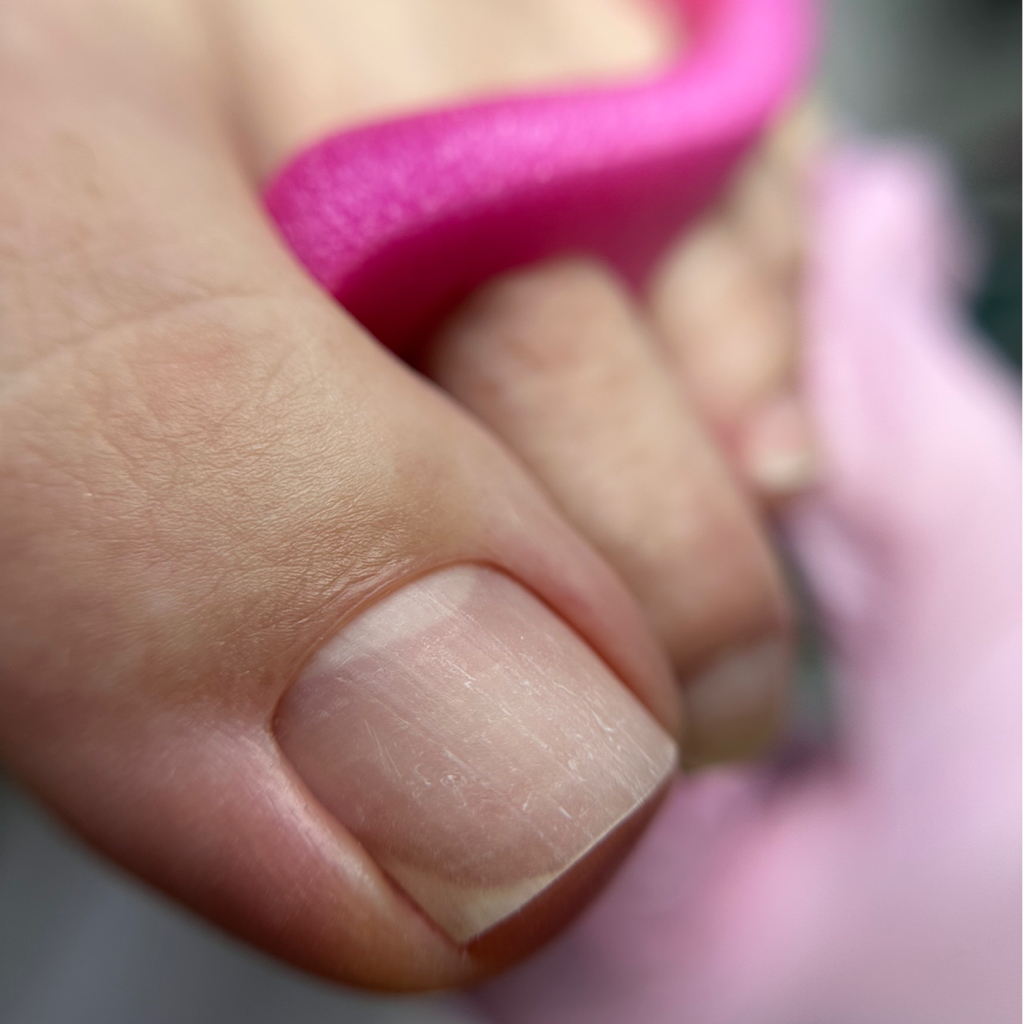 Педикюр (гигиена)