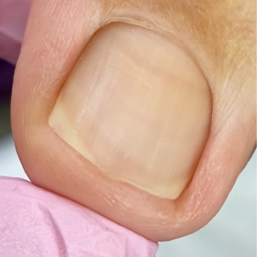 Мужской педикюр