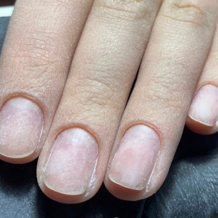 Снятие БЕЗ маникюра