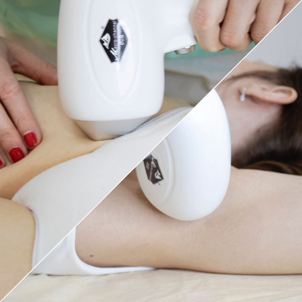 Лазерная эпиляция подмышки + бикини