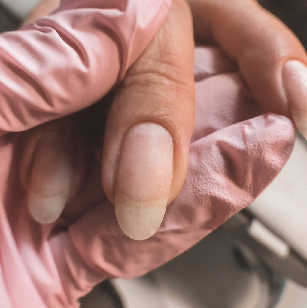 Снятие гл без последующего покрытия