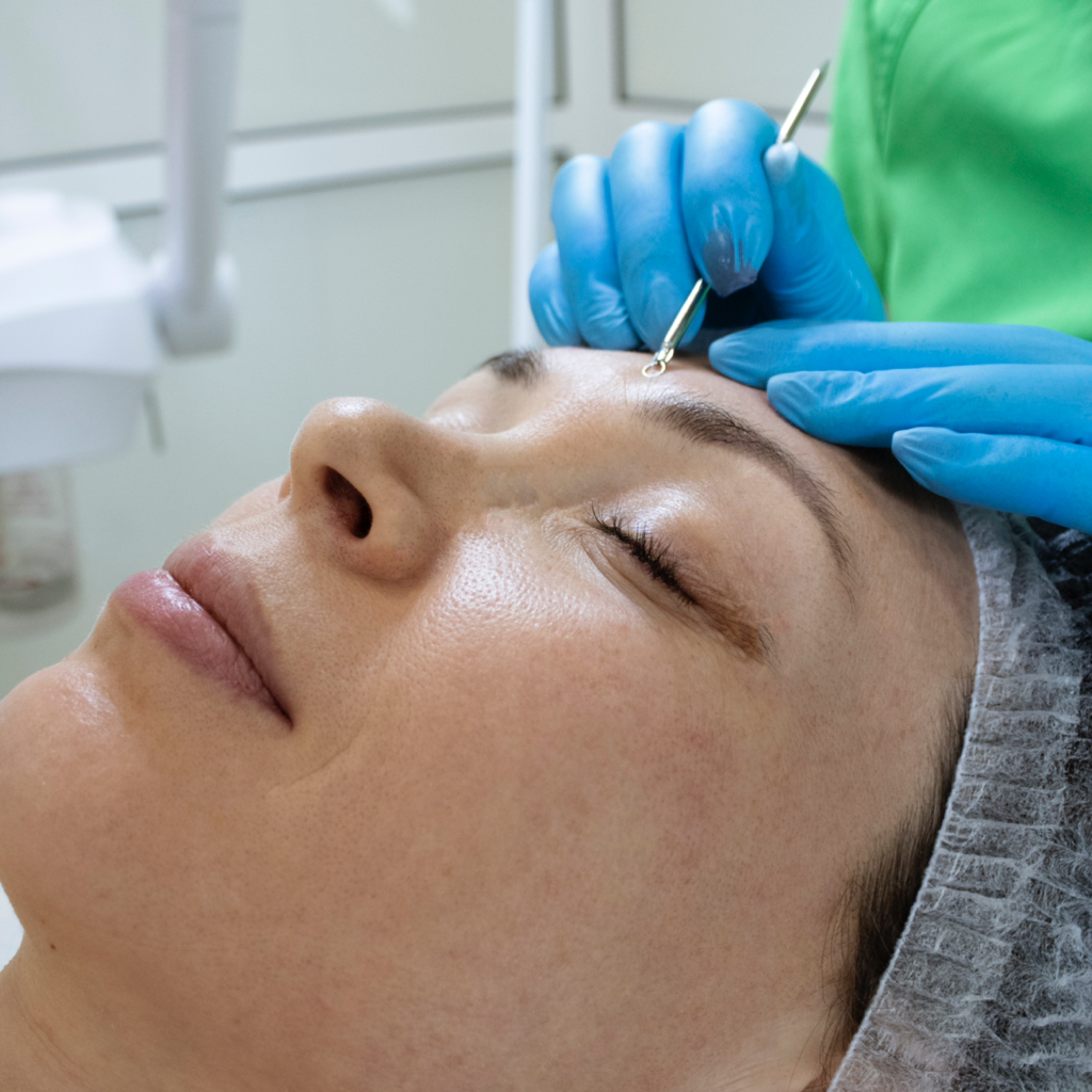 Механическая чистка лица