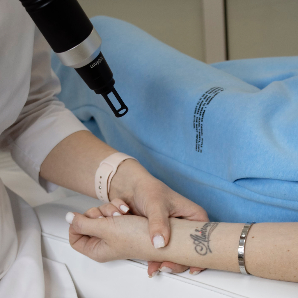 Удаление татуировок