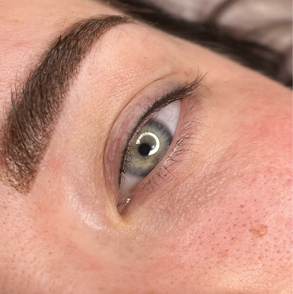 PM Межресничка