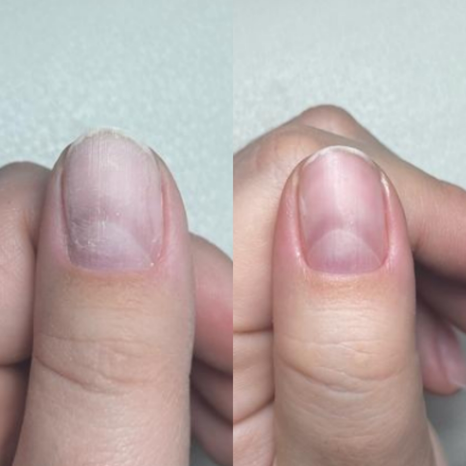 IBX SYSTEM (восстановление ногтей)