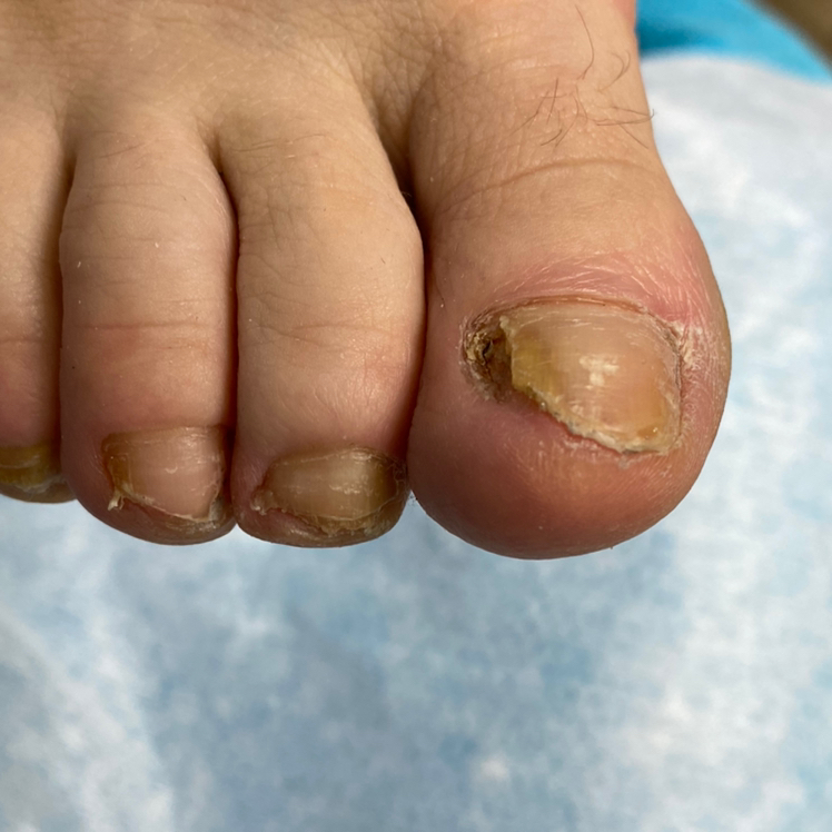 Медицинский педикюр (1-2 степени сложности)