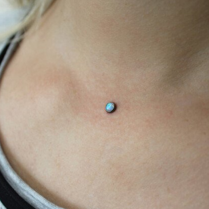 Чистка/удаление микродермала