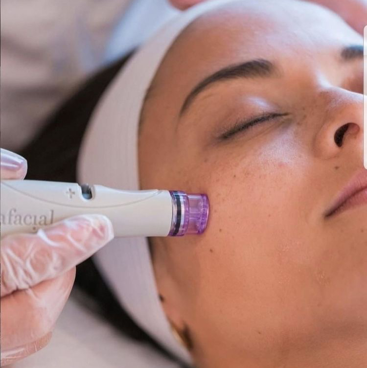 Атравматическая чистка лица