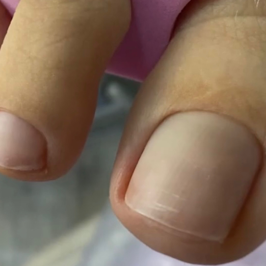 Педикюр пальцев без покрытия