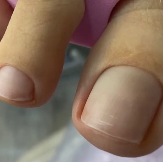 Педикюр с полной обработкой (без покрытия)