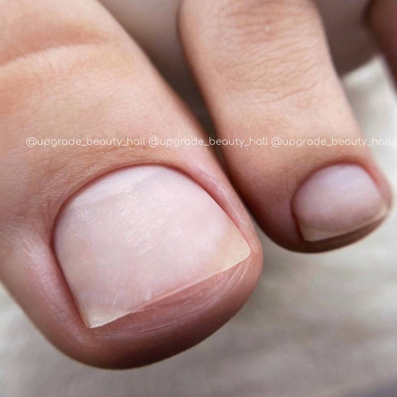 Обработка только пальчиков