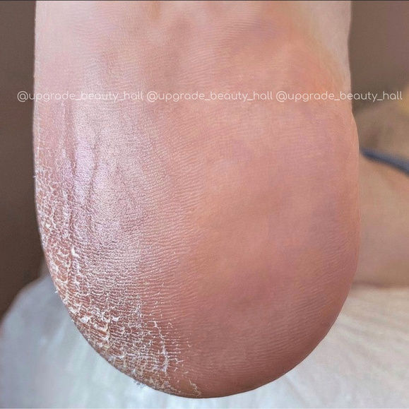 Аппаратный/комби-педикюр без покрытия