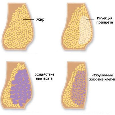 ЛИПОЛИТИКИ