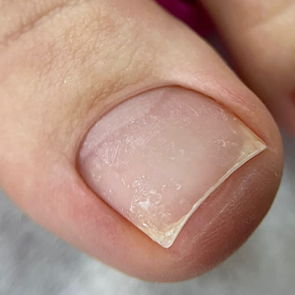 Гигиенический педикюр (Обработка пальчиков и стоп)