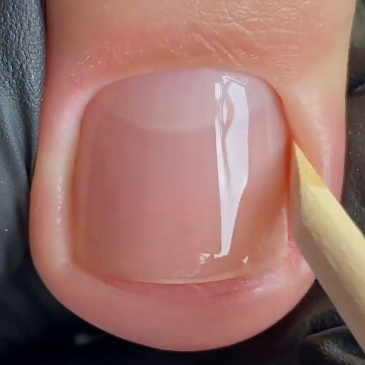 Гигиеническая обработка пальчиков