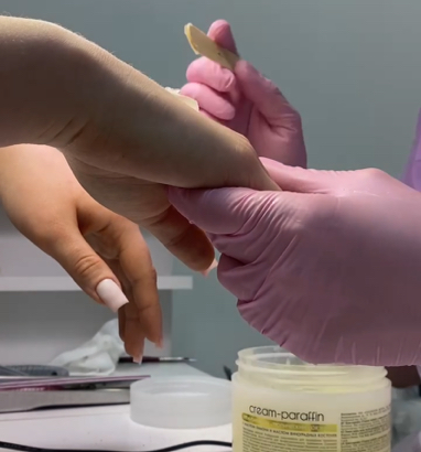 ПАРАФИНОТЕРАПИЯ