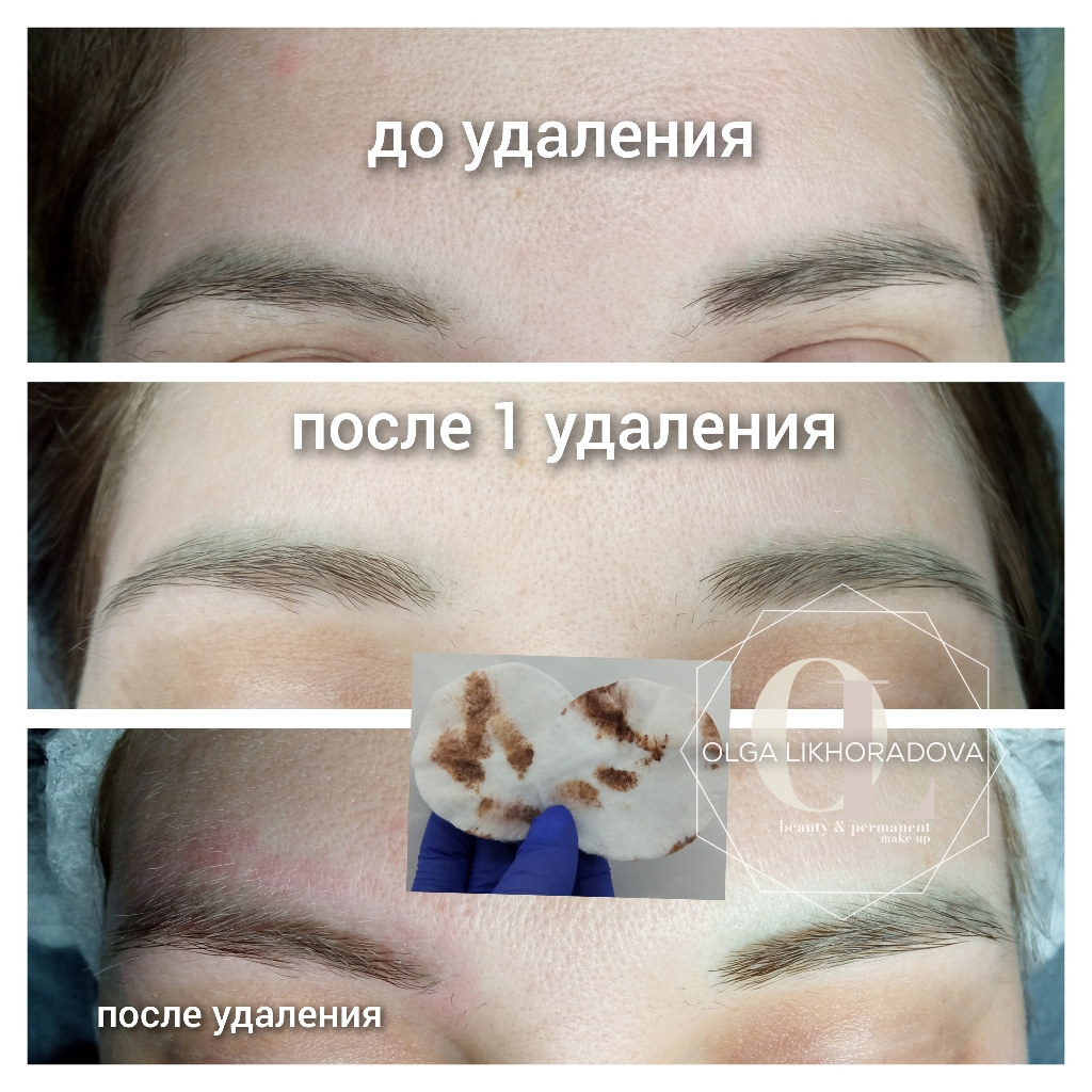 ремувер