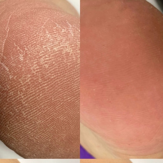 Педикюр без покрытия