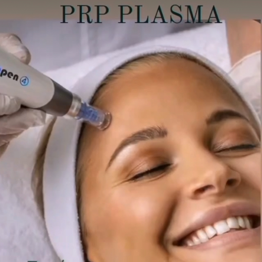 PRP -PLASMA THERAPY  (derma-pen)