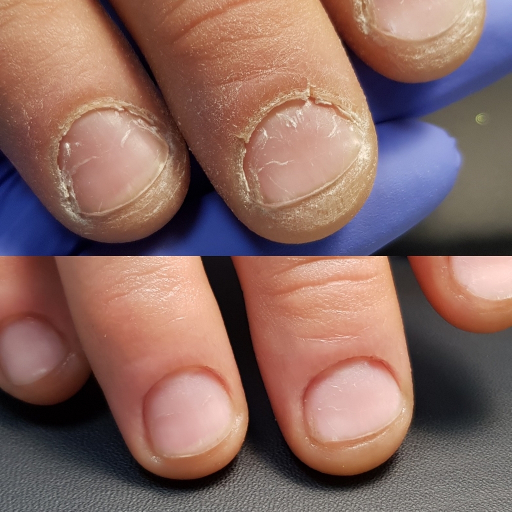 Гигиенический маникюр без покрытия