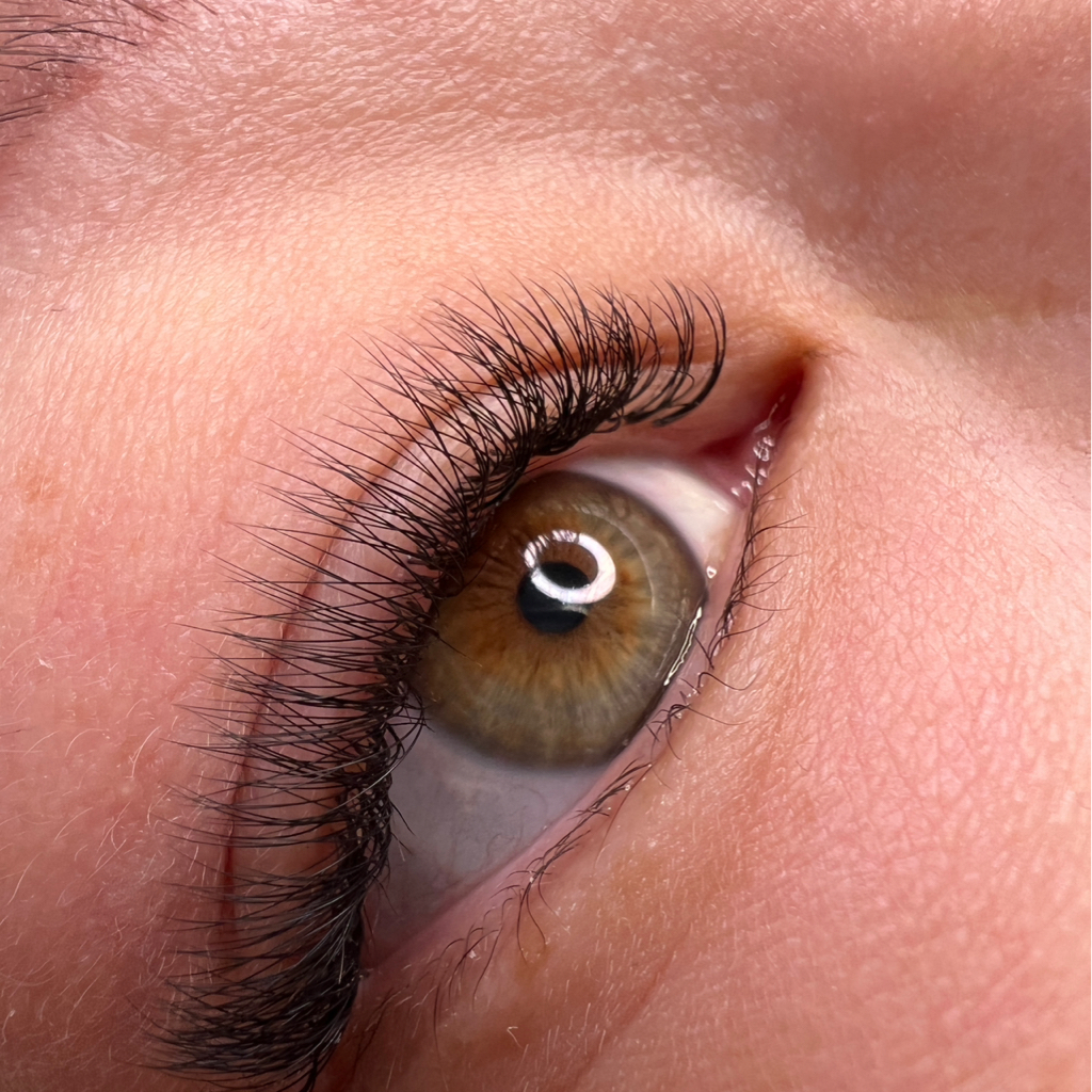 Наращивание Ренсиц 1,5D