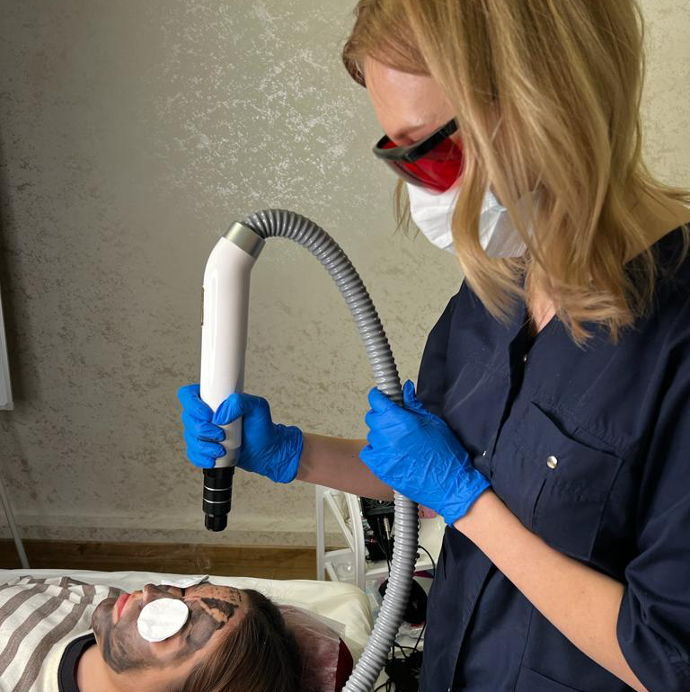 Карбоновый пилинг