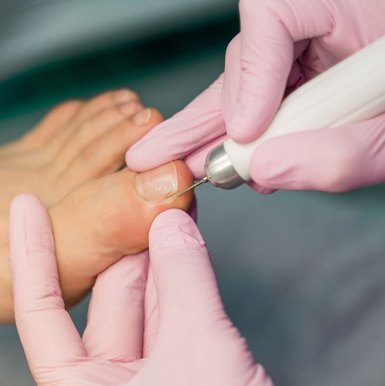 Обработка пальчиков