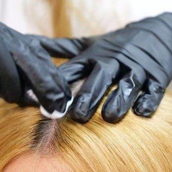 Скрабирование кожи головы