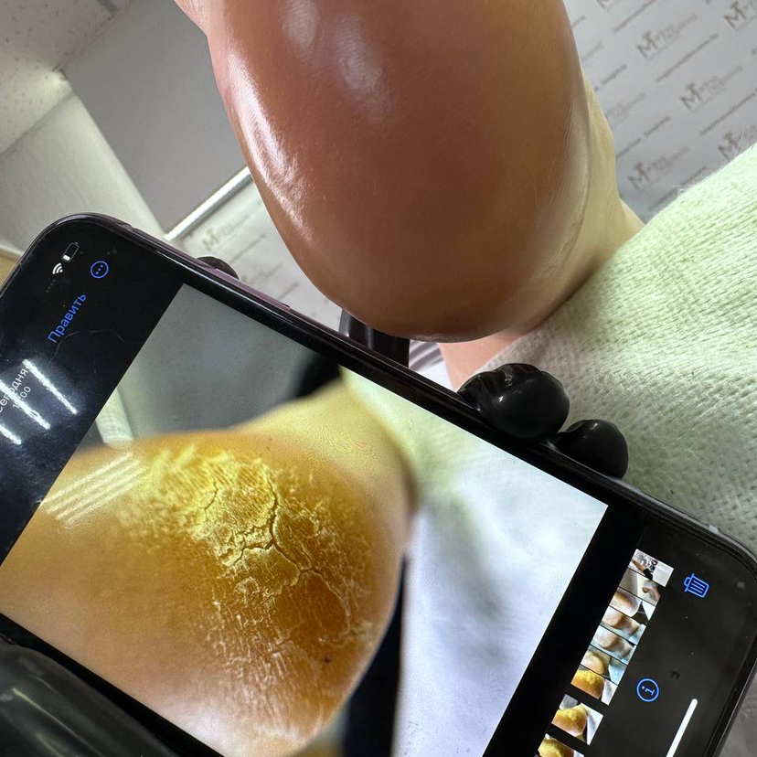 Smart pedicure / СМАРТ педикюр без покрытия