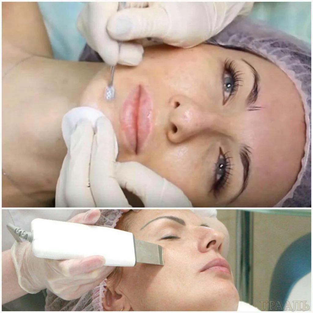 Комплексная чистка лица.