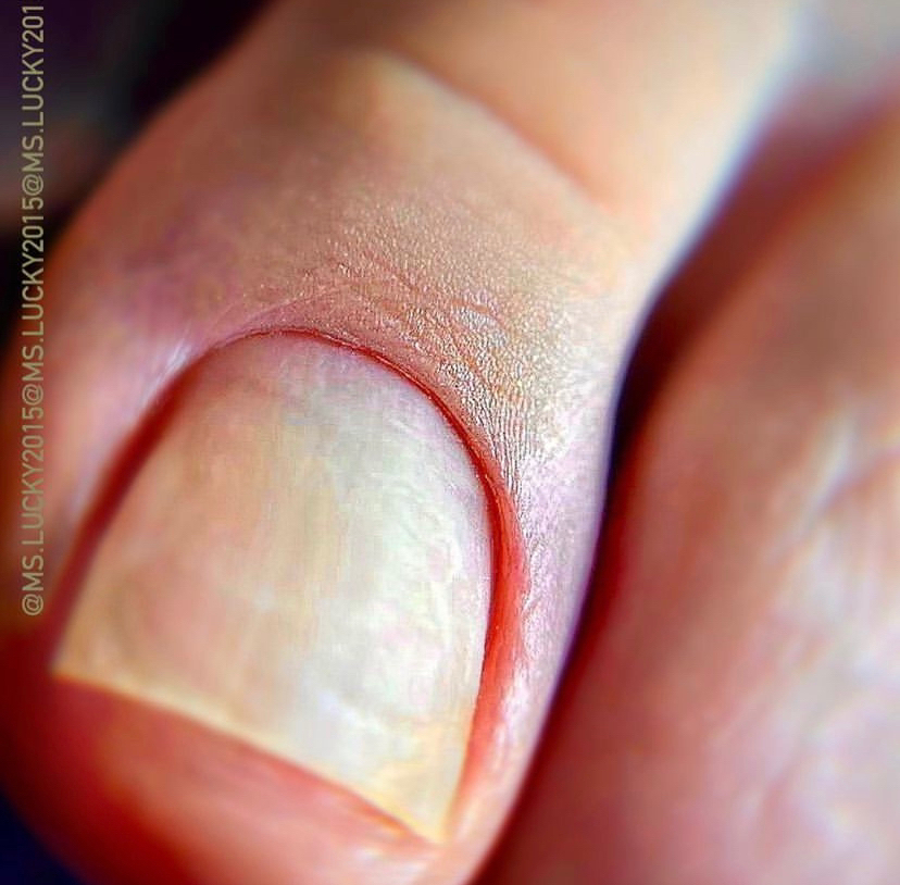 Мини Педикюр БЕЗ гель-покрытия + лак 8/1 =5000 тг | TOP-мастер 2 категории