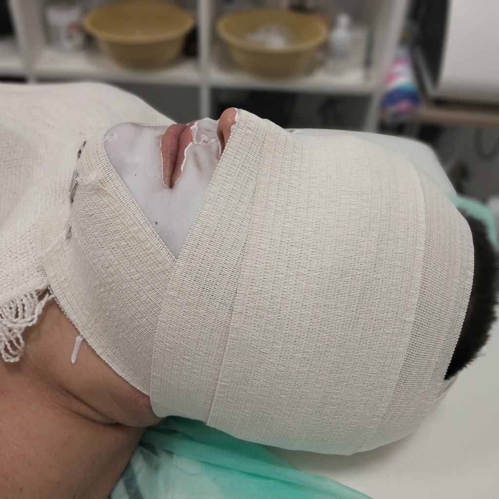 глубокий лифтинг комплекс с бандажным обертыванием.