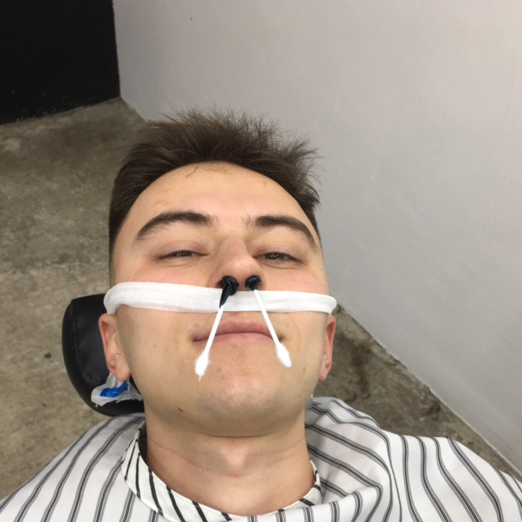 Удаление волос воском/Hair removal with wax