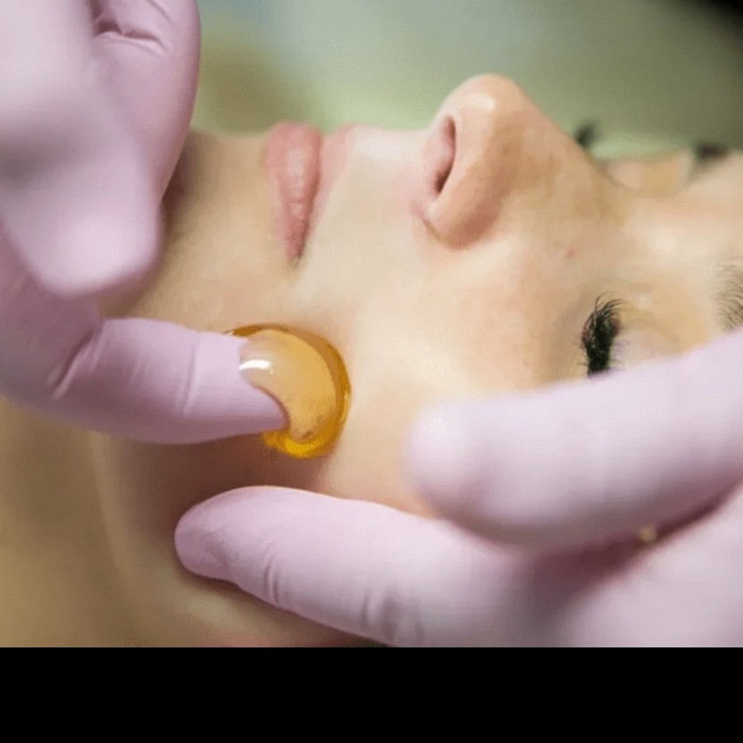 Депиляция лица 1 зона  (сахар/воск)